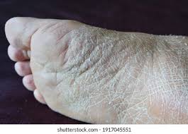 Raw Texture — up close and detailed